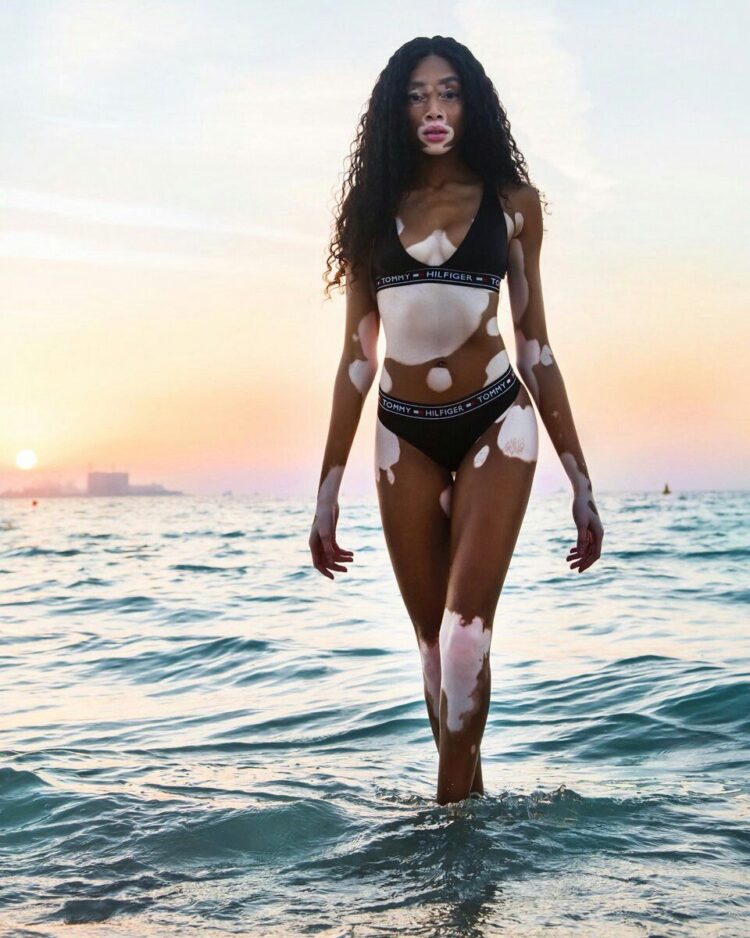 Winnie Harlow